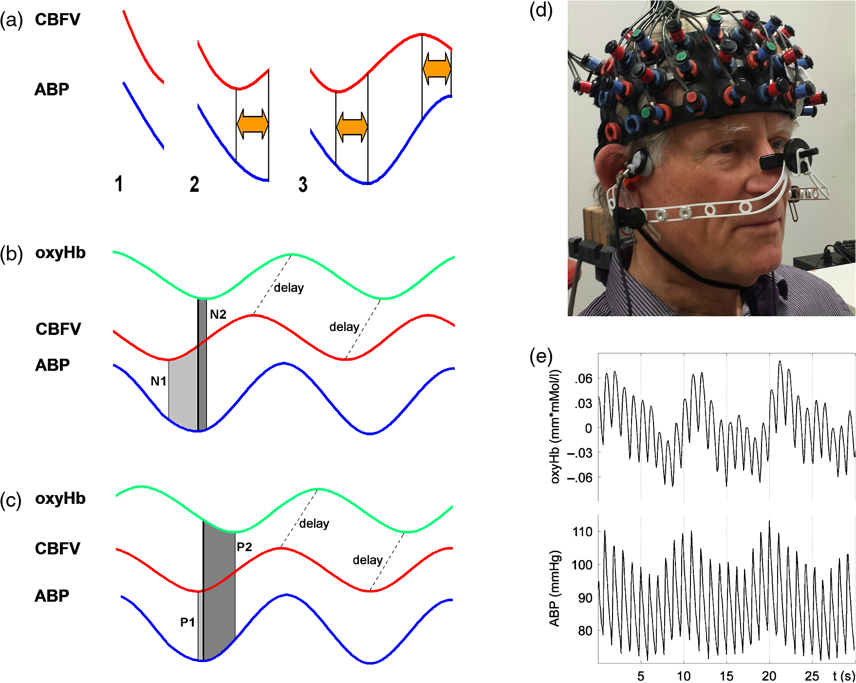 Spatial Mapping Of Dynamic Cerebral Autoregulation By Multichannel Near