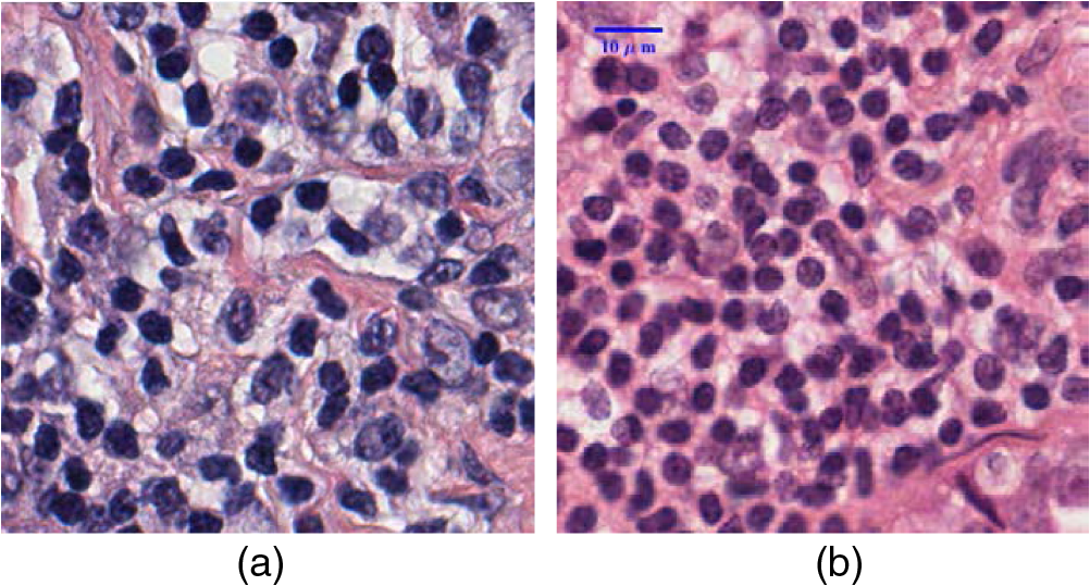 Automatic Extraction Of Cell Nuclei From H E Stained Histopathological