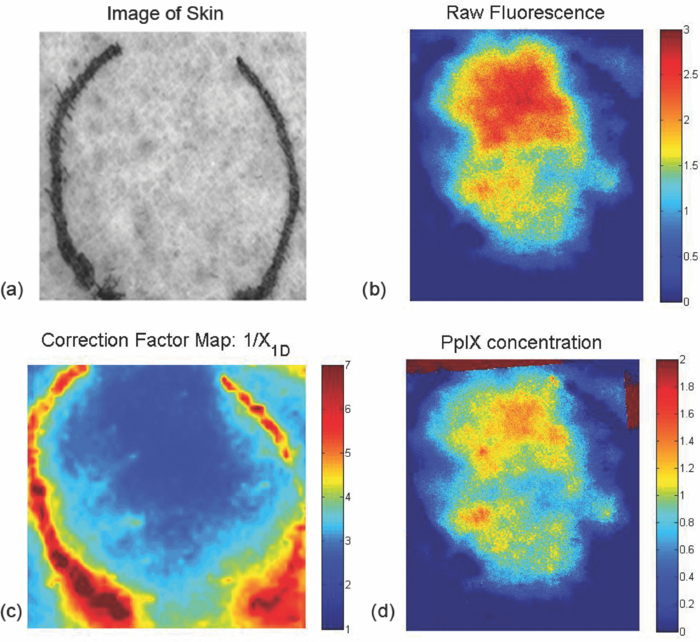 Quantitative fluorescence imaging of protoporphyrin IX through ...