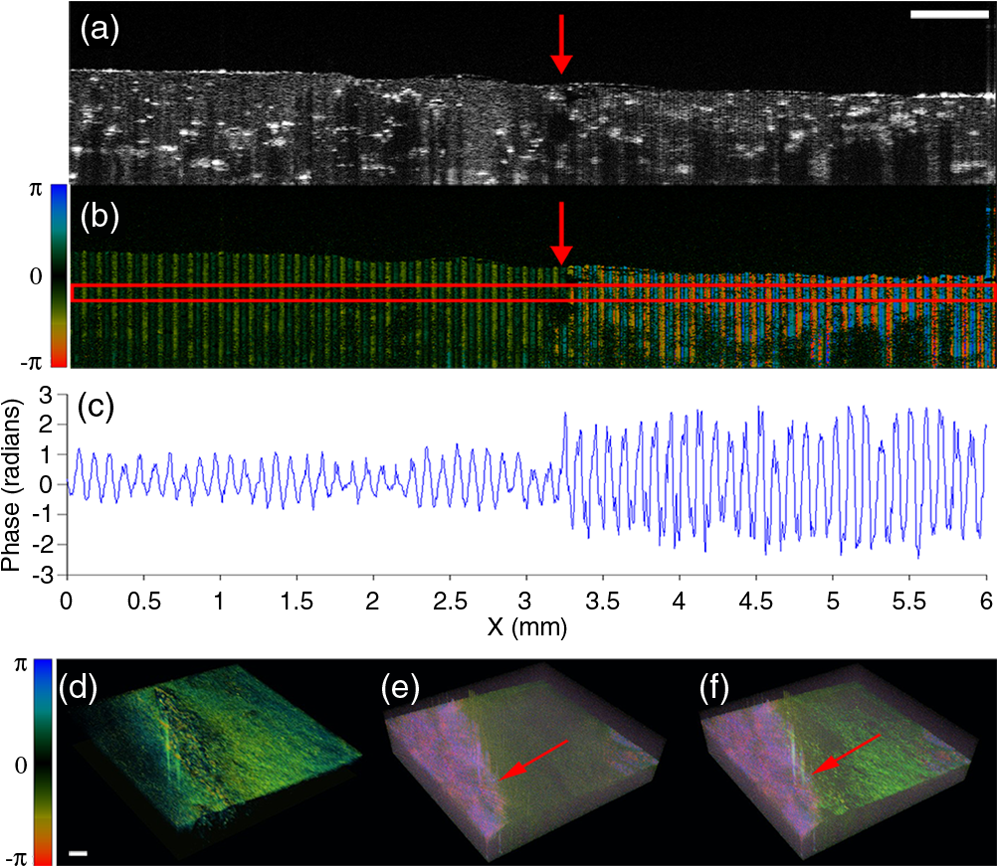 Phase-resolved Acoustic Radiation Force Optical Coherence Elastography