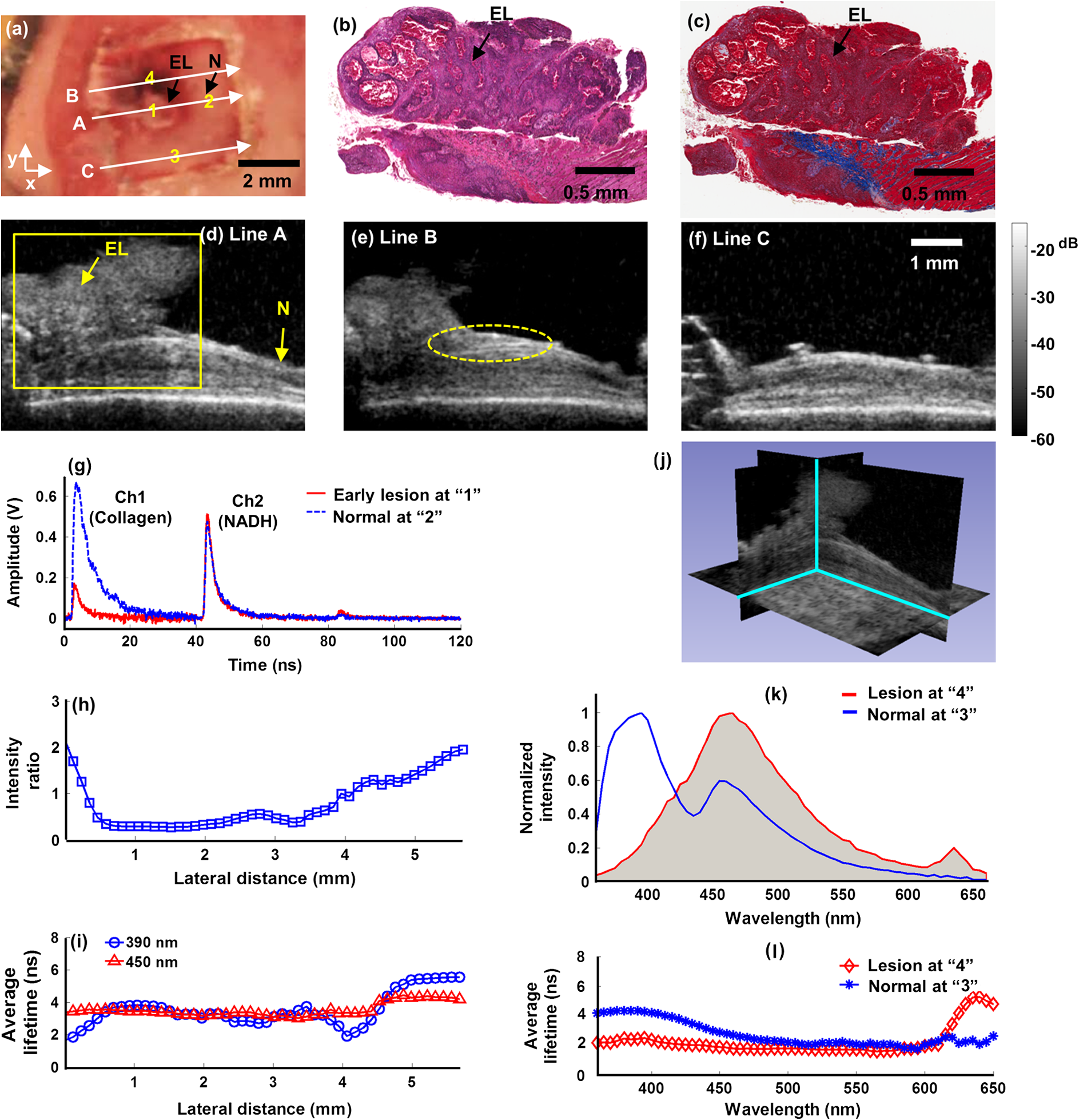 In-vivo validation imaging of a hamster cheek pouch: (A) fluorescence
