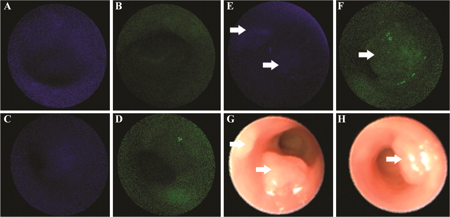 Targeted detection of murine colonic dysplasia in vivo with flexible ...