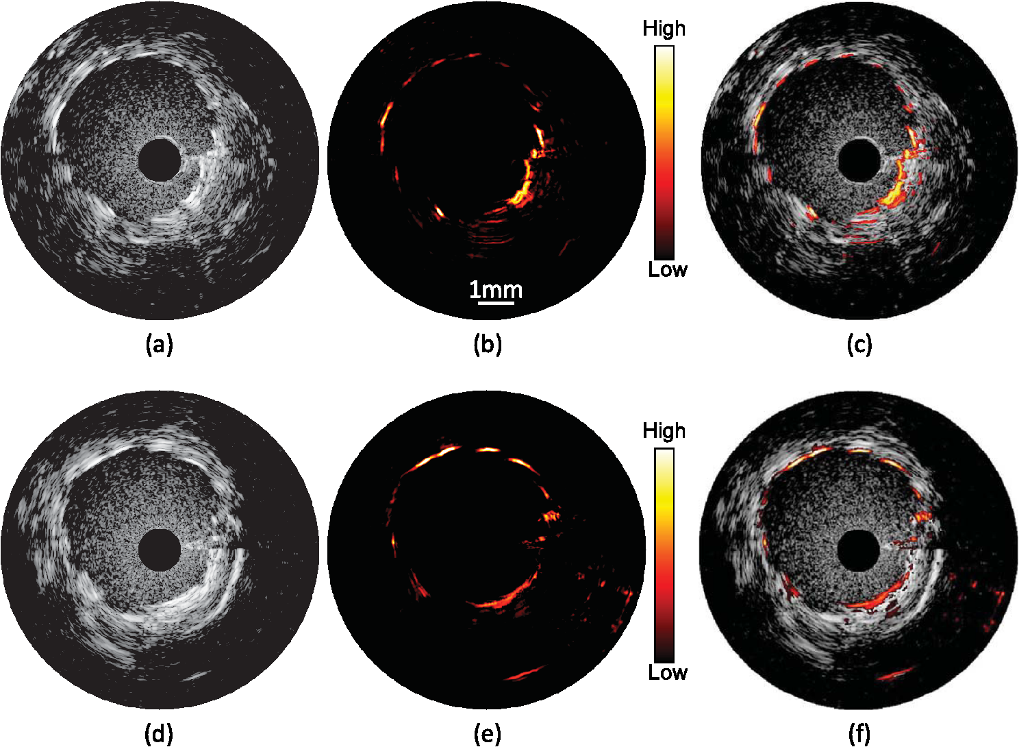 Feasibility Of In Vivo Intravascular Photoacoustic Imaging Using