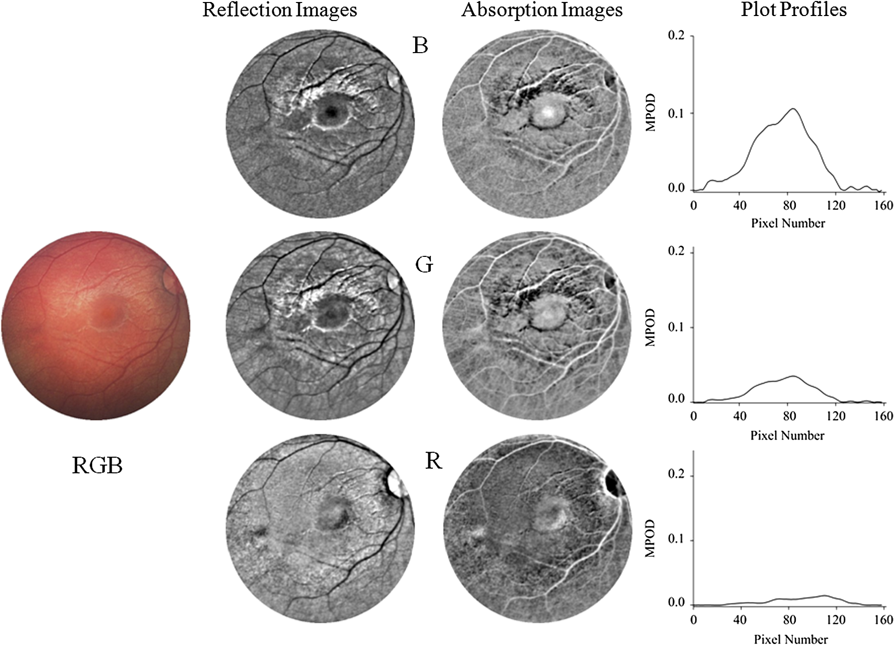 Reflection-based Imaging Of Macular Pigment Distributions In Infants ...