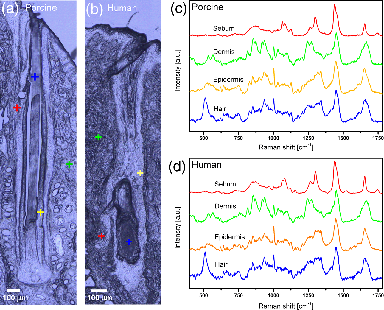 Human Hair Root Under Microscope - Micropedia