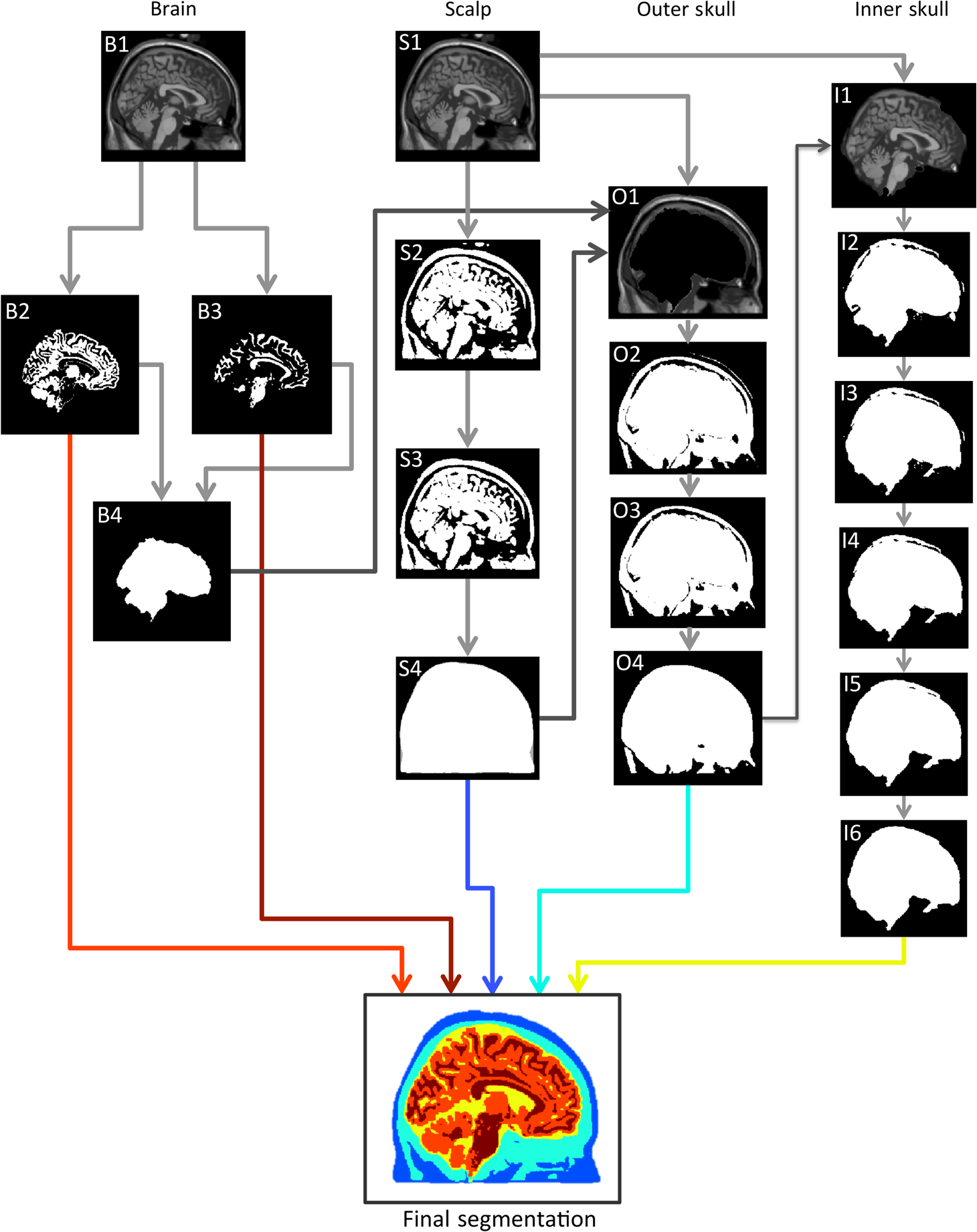 T1 magnetic resonance imaging head segmentation for diffuse optical ...