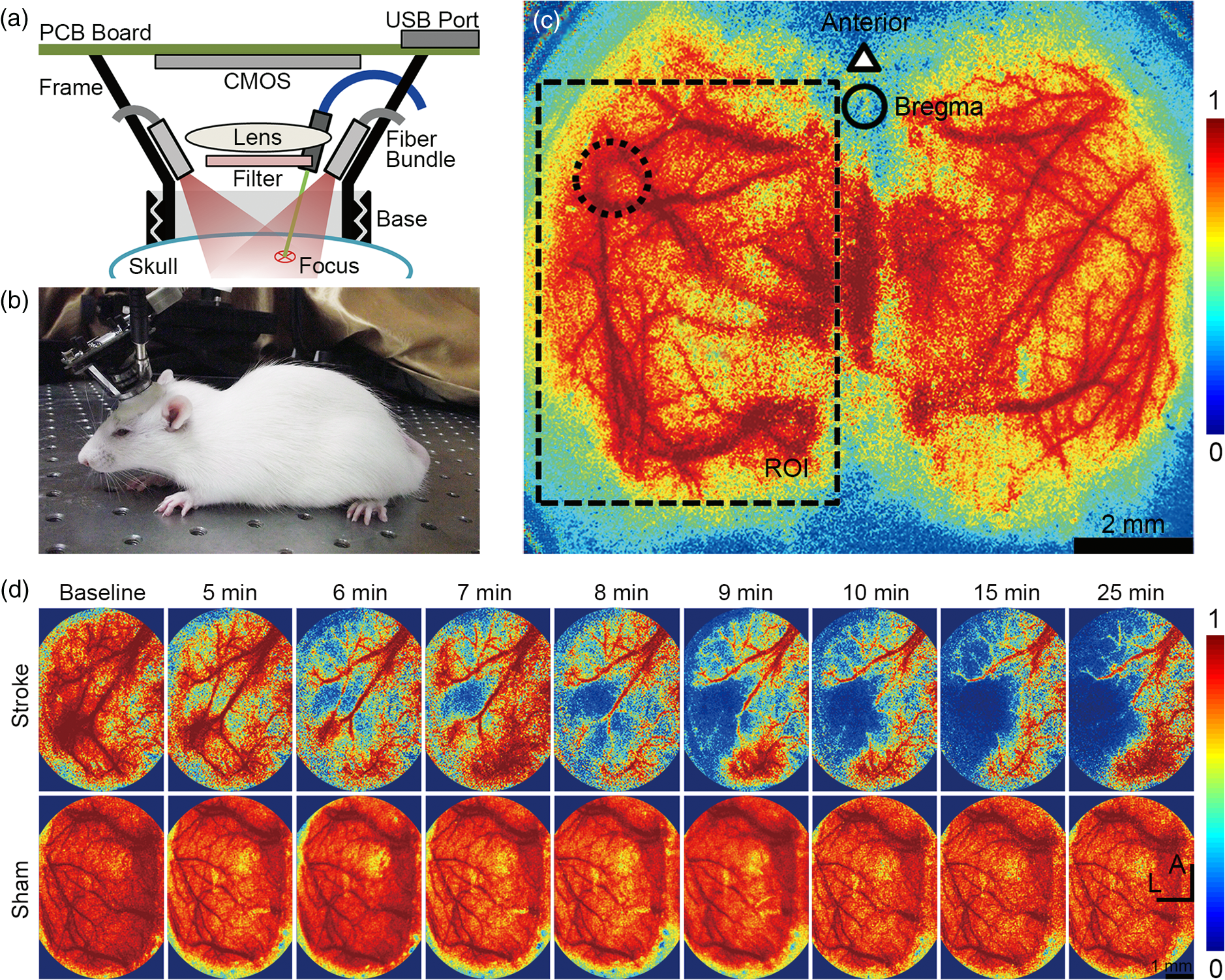 5to10 Mb Porn Video - Induction and imaging of photothrombotic stroke in conscious and ...