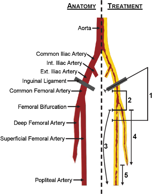Femoral Ring Anatomy