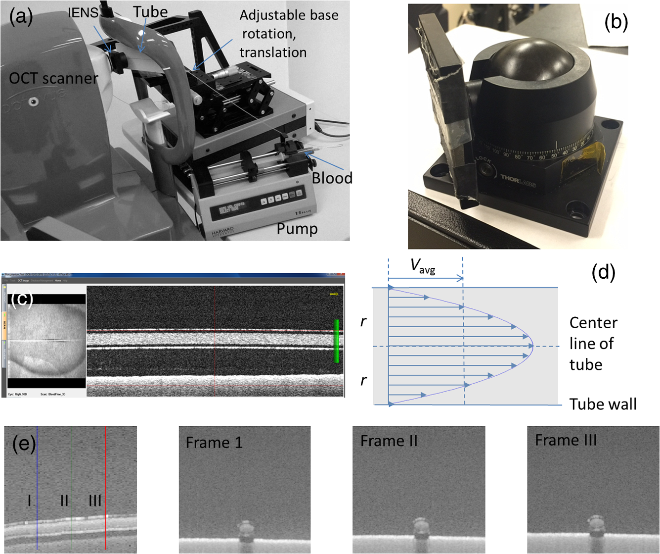 En face Doppler total retinal blood flow measurement with 70 kHz ...