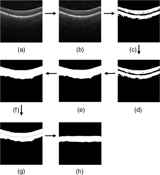 Fully automated macular pathology detection in retina optical coherence ...