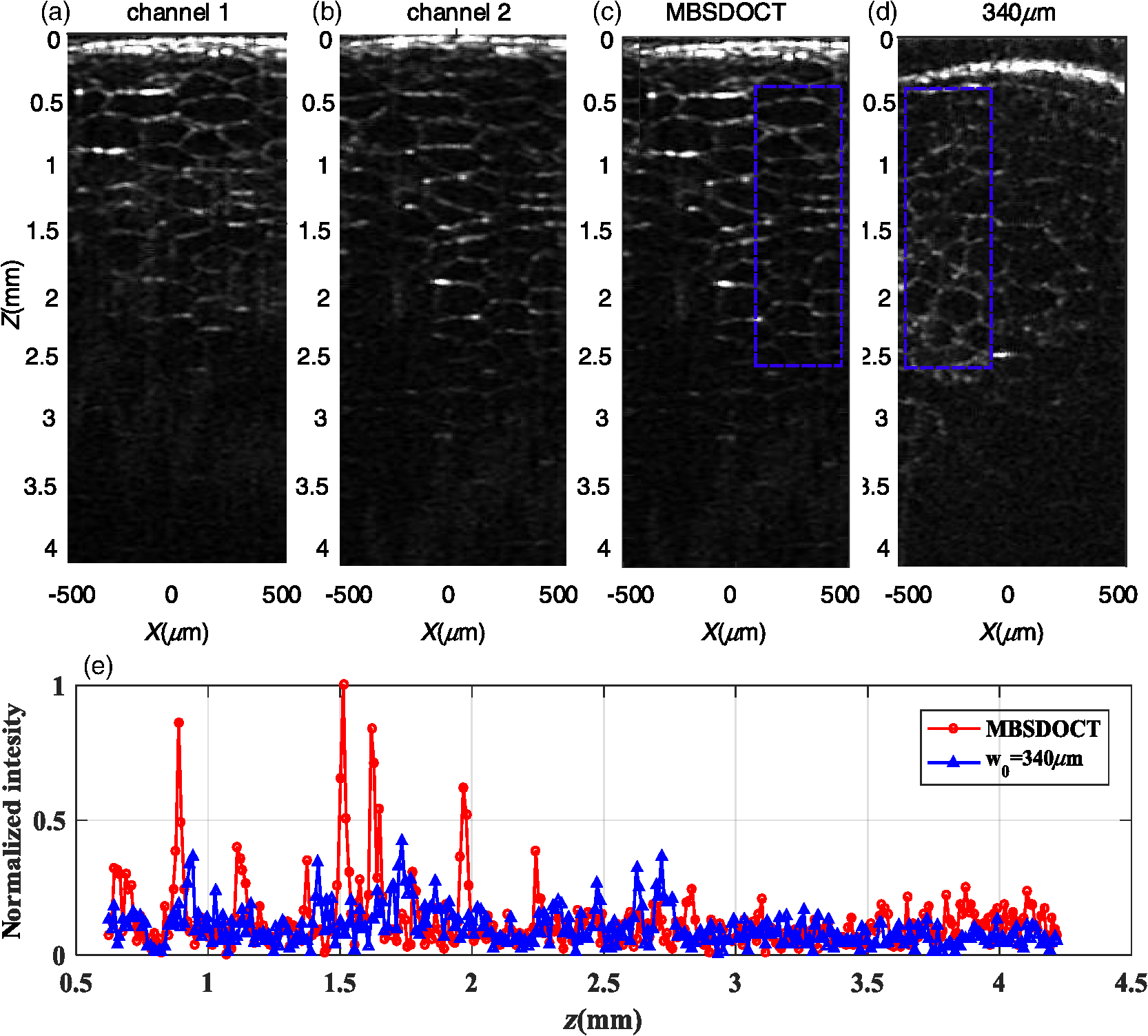 Multifocal Spectral Domain Optical Coherence Tomography Based On Bessel Beam For Extended Imaging Depth