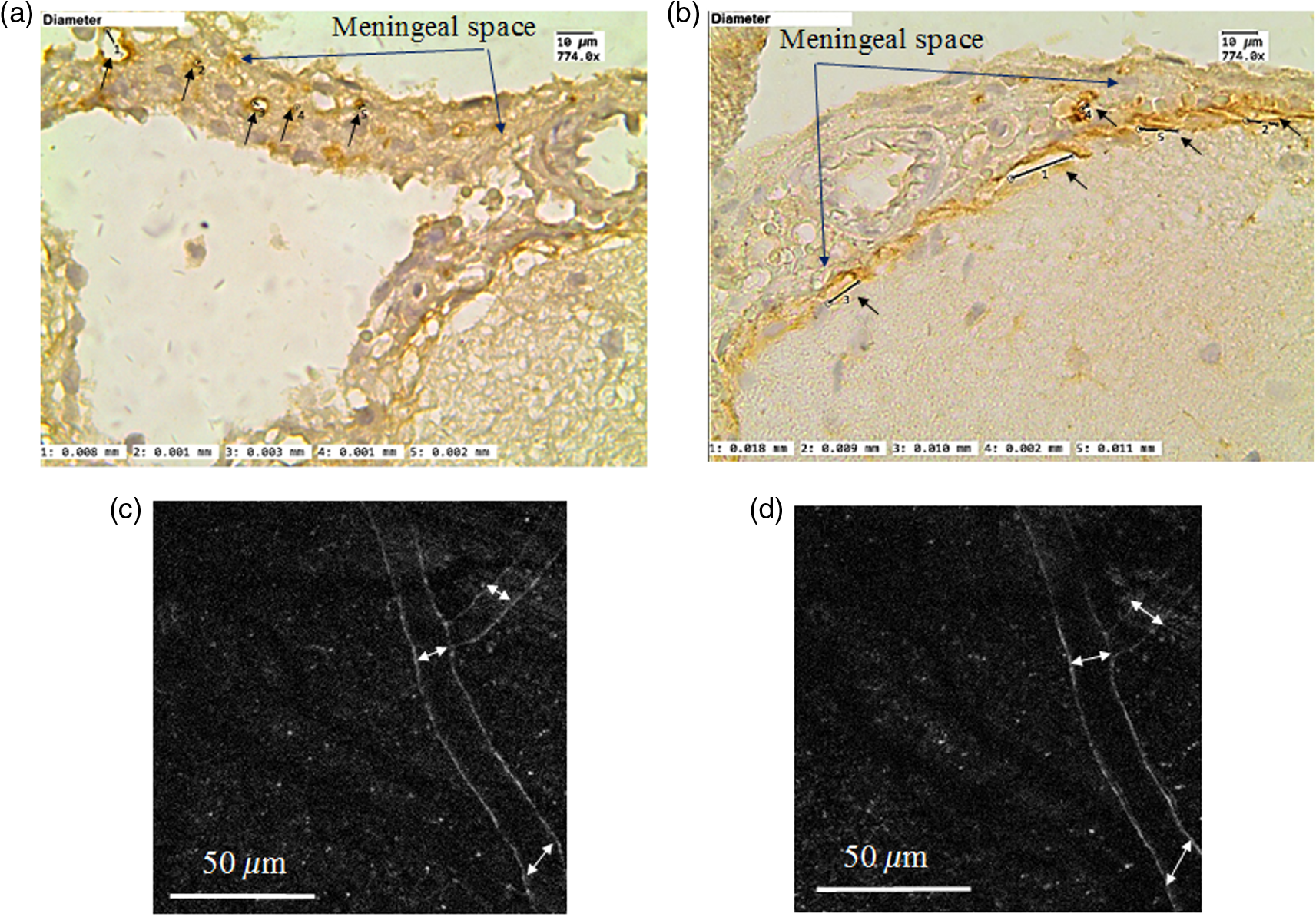 Application Of Optical Coherence Tomography For In Vivo Monitoring Of The Meningeal Lymphatic Vessels During Opening Of Blood Brain Barrier Mechanisms Of Brain Clearing