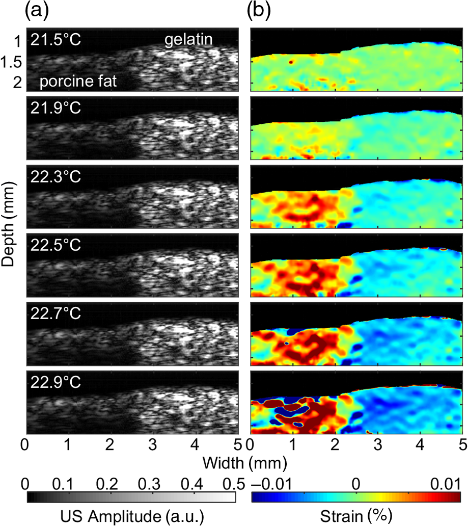 Photothermal strain imaging