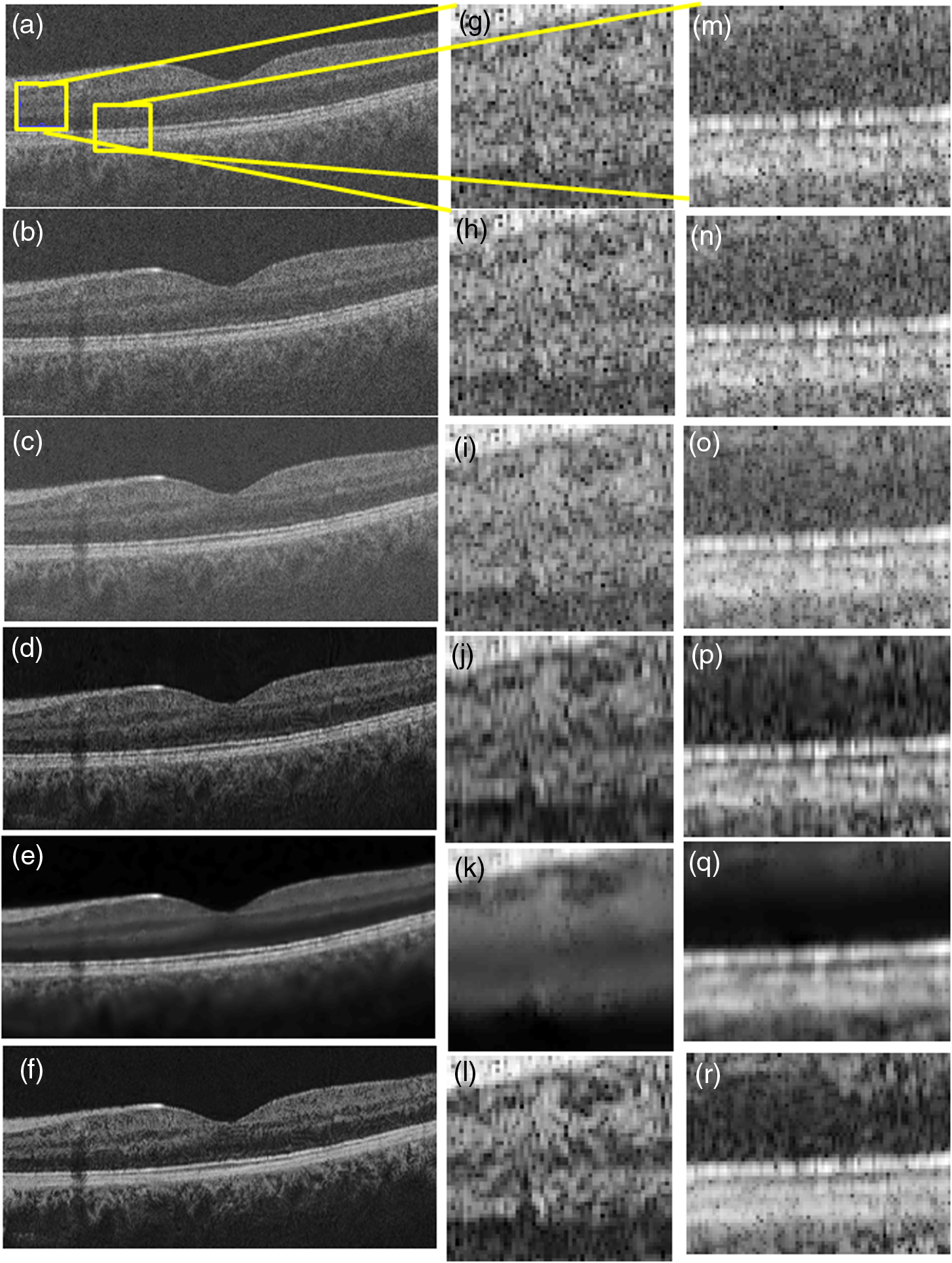 Optical Coherence Tomography Image Denoising Using Gaussianization Transform