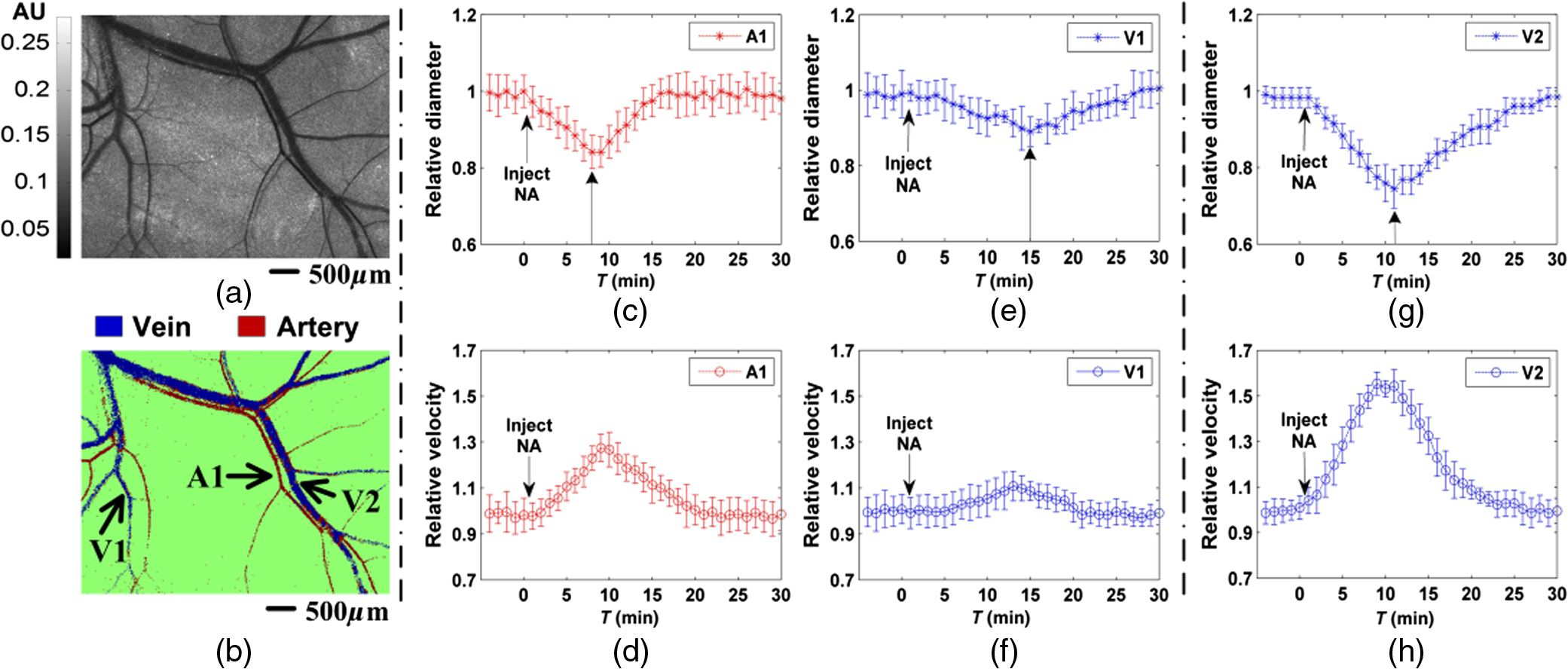 Measurement Of Tissue Optical Properties In The Context Of Tissue ...