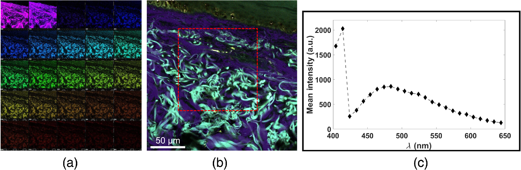 Dermal fiber structures and photoaging