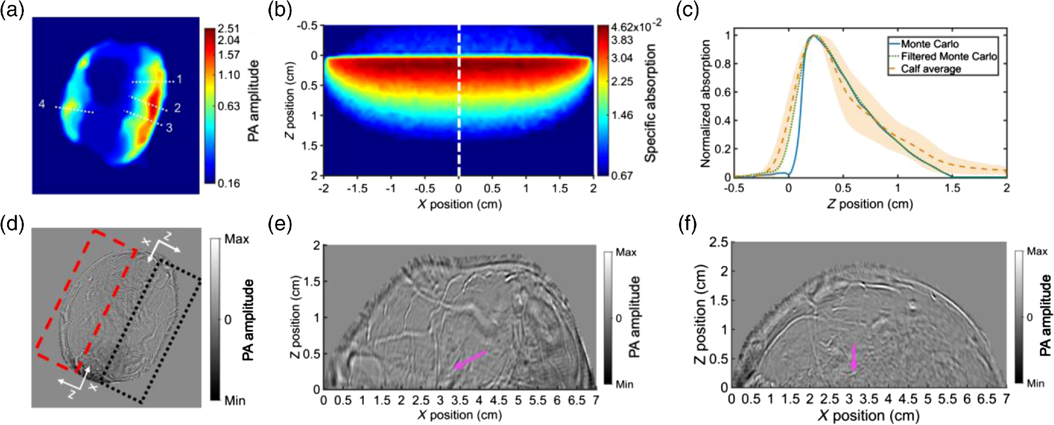 Photoacoustic computed tomography of human extremities