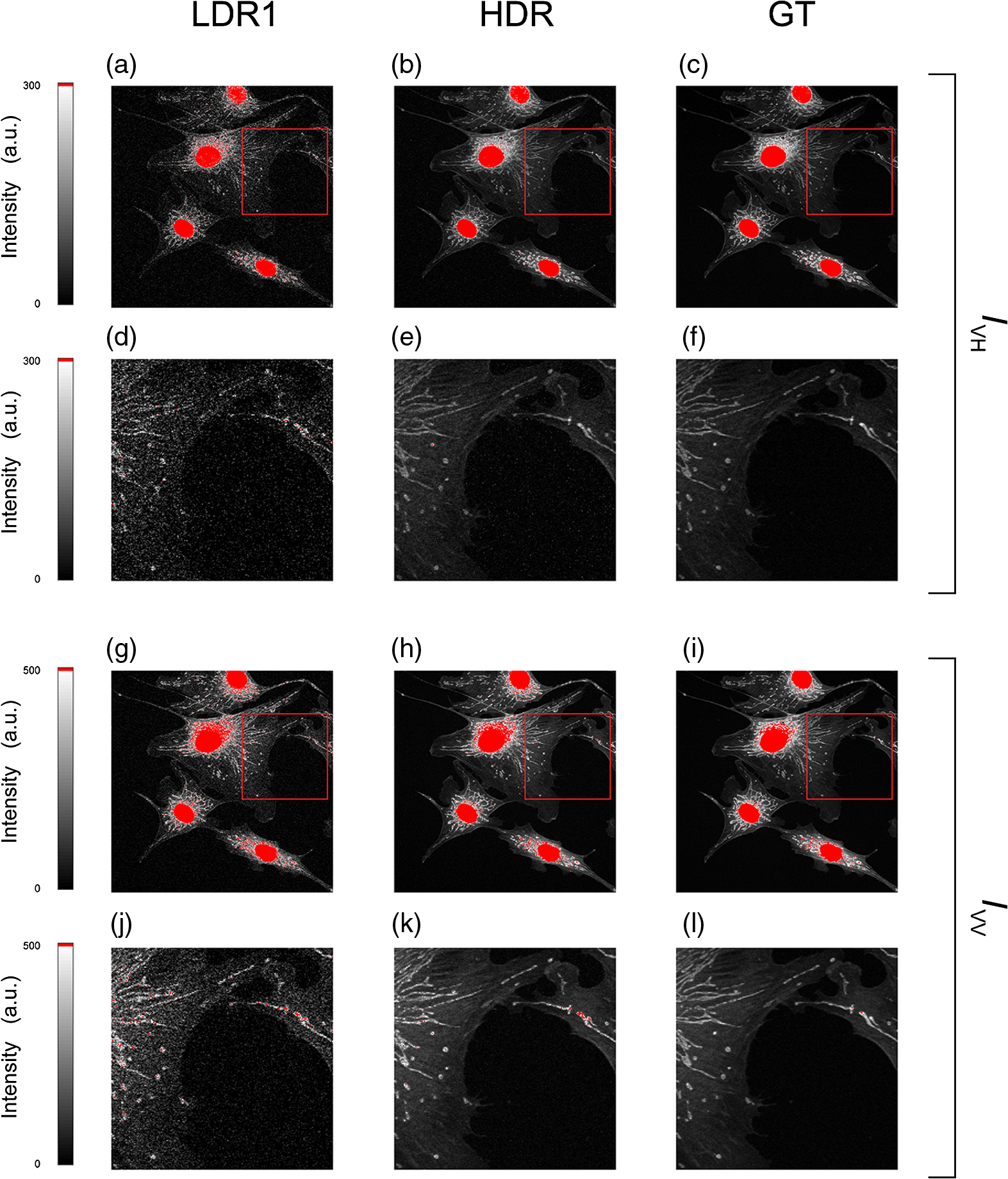 Extended Dynamic Range Imaging For Noise Mitigation In Fluorescence Anisotropy Imaging