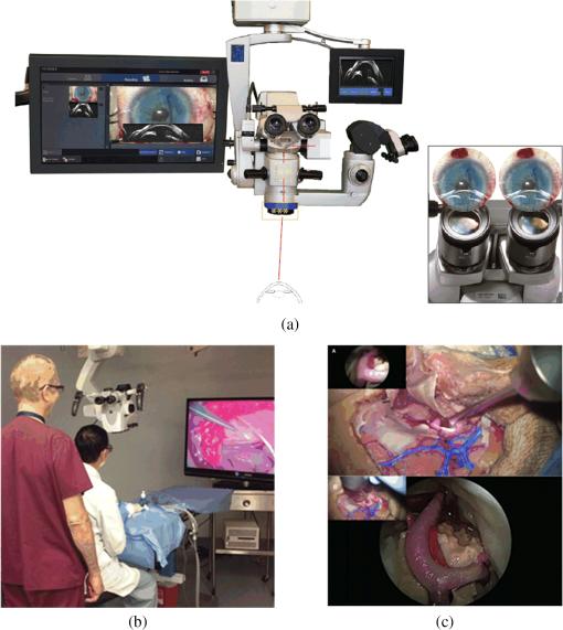 Comprehensive review of surgical microscopes: technology development and  medical applications