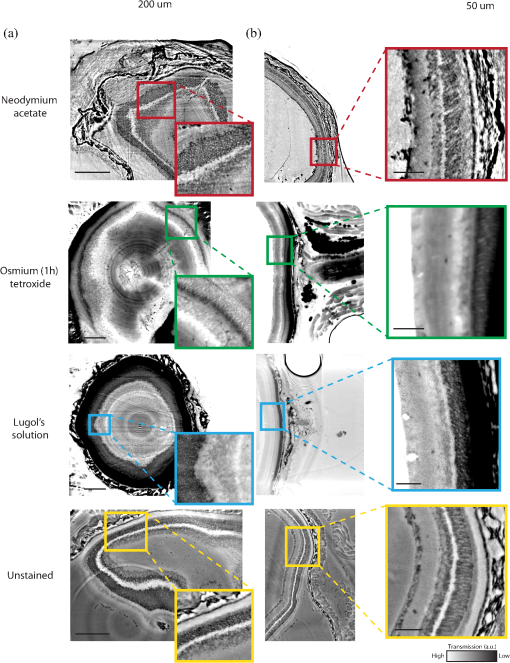 JMI_10_5_056001_f004.png