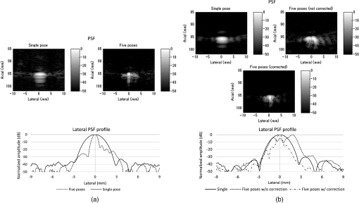 Synthetic tracked aperture ultrasound imaging: design, simulation, and ...