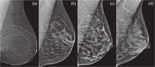 Review Of Quantitative Multiscale Imaging Of Breast Cancer - 