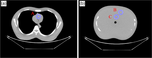 Protocols For Multislice Ct Ebook