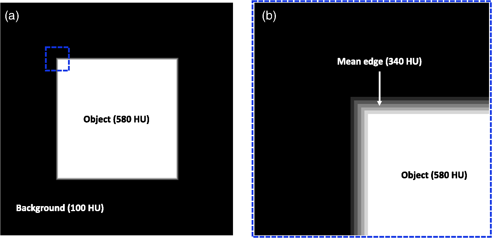 Anthropomorphic Left Ventricular Mesh Phantom A Framework To Investigate The Accuracy Of Squeez Using Coherent Point Drift For The Detection Of Regional Wall Motion Abnormalities