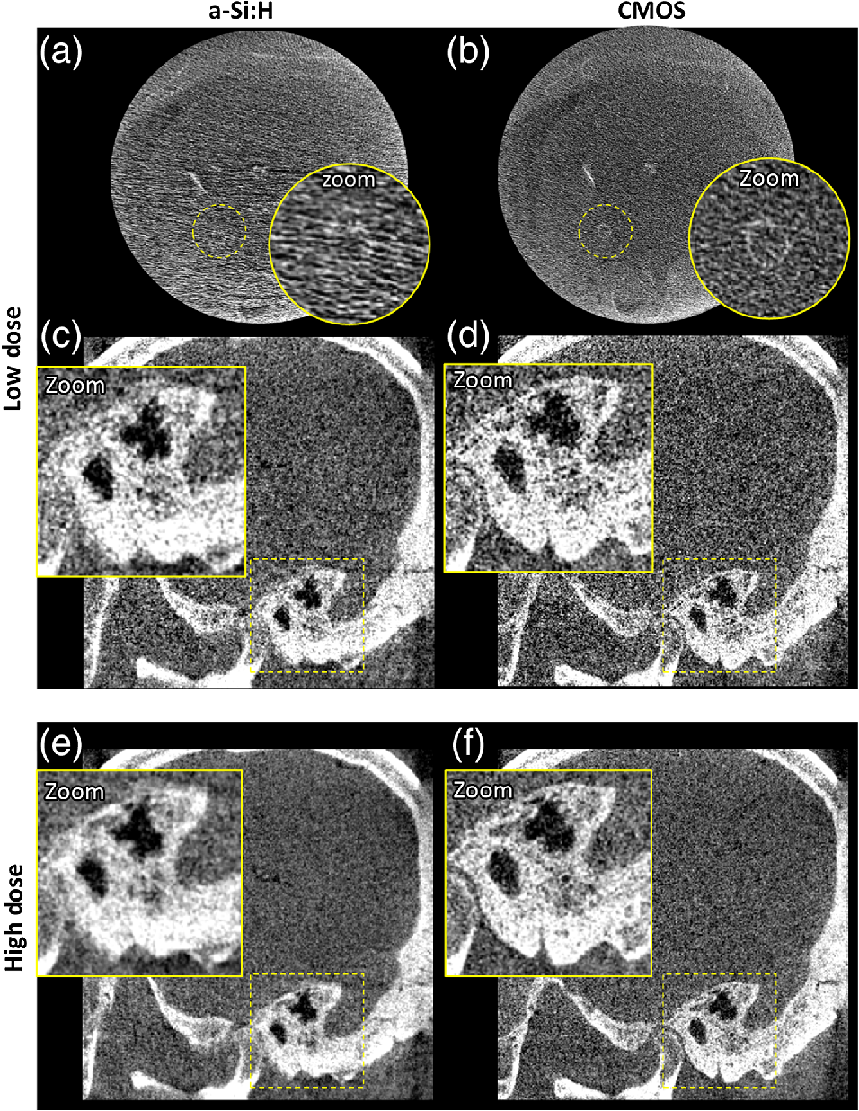 Evaluation Of Image Quality And Task Performance For A Mobile C Arm With A Complementary Metal Oxide Semiconductor Detector