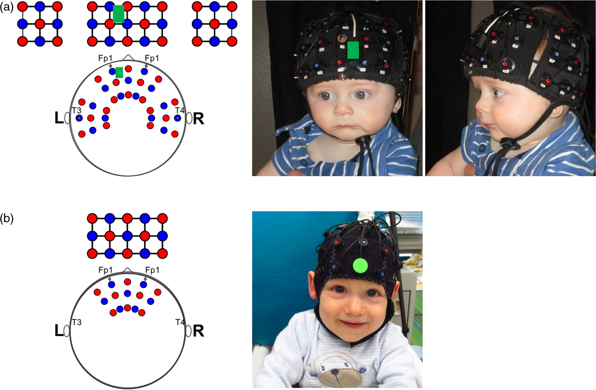 Motion correction for infant functional near-infrared spectroscopy with ...