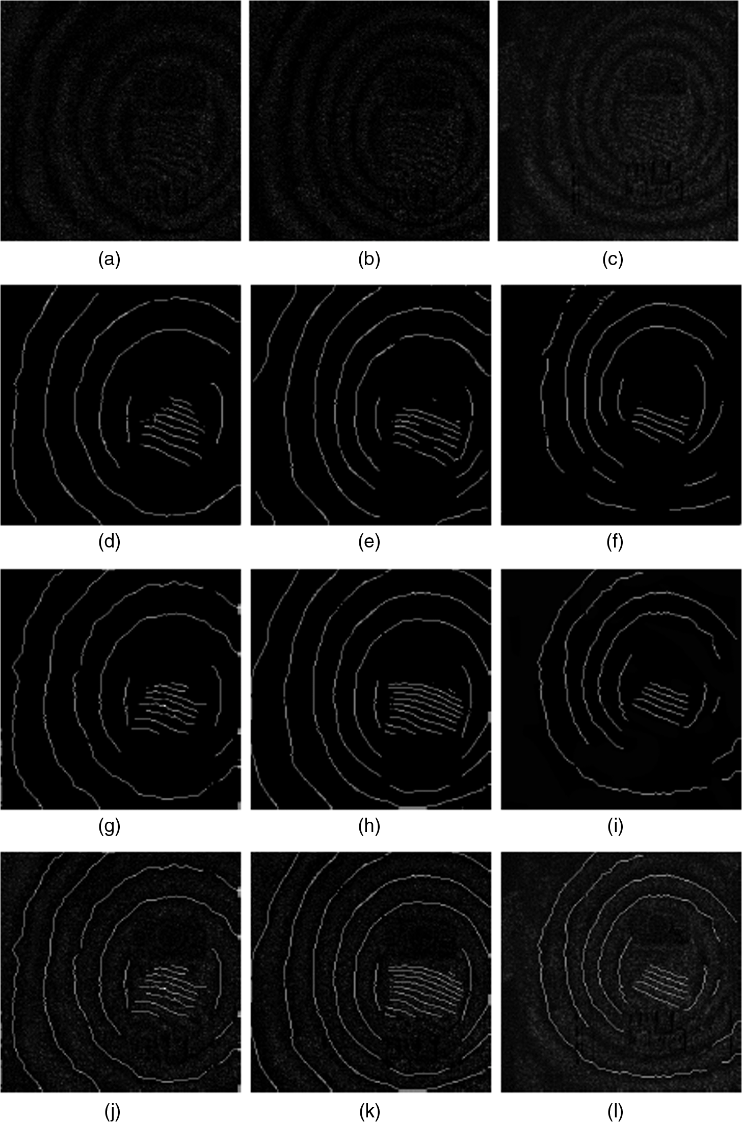 Fully Automated Extraction Of The Fringe Skeletons In Dynamic Electronic Speckle Pattern Interferometry Using A U Net Convolutional Neural Network