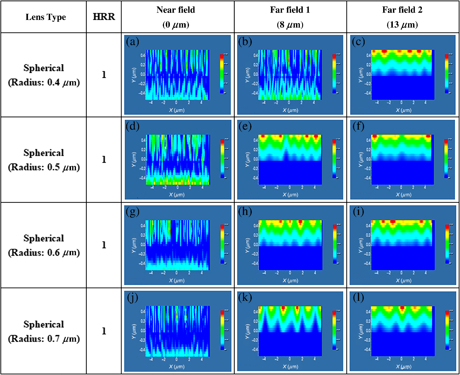 Improvement Of Light Intensity And Efficiency Of N Zno Nio P Gan Heterojunction Based White Light Emitting Diodes Using Micro Nanolens Array