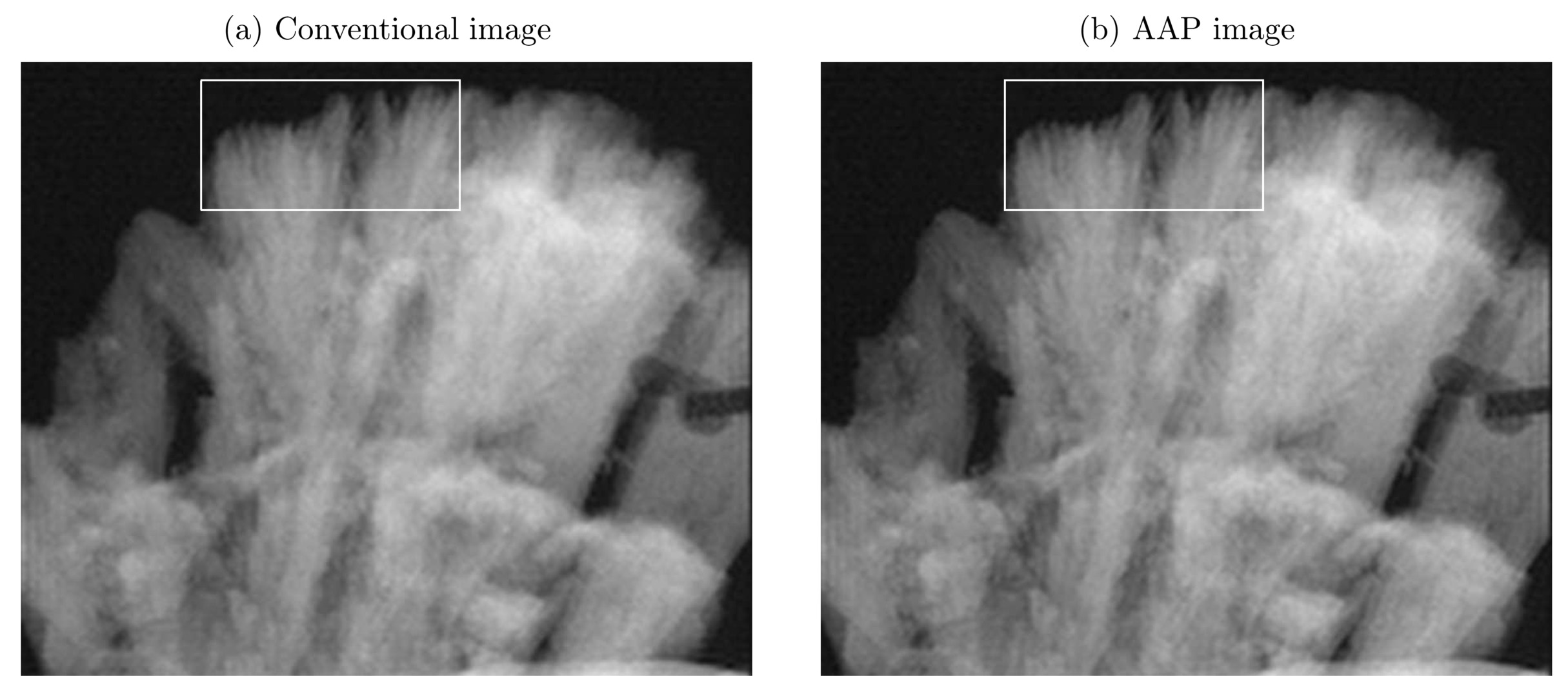 Performance Evaluation Of A Se Cmos Prototype X Ray Detector With The Apodized Aperture Pixel p Design