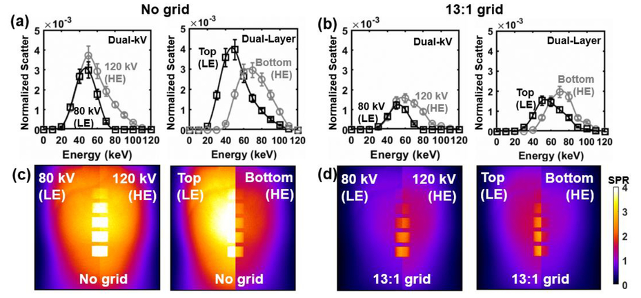 Effects Of X Ray Scatter In Quantitative Dual Energy Imaging Using Dual Layer Flat Panel Detectors