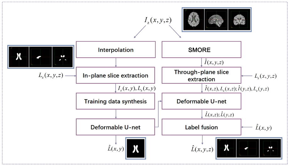 Label Super Resolution For 3d Magnetic Resonance Images Using Deformable U Net