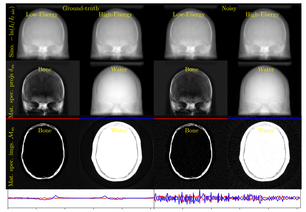 Iterative Reconstruction Anti Correlated Rof Model For Noise Reduction In Dual Energy Cbct Imaging