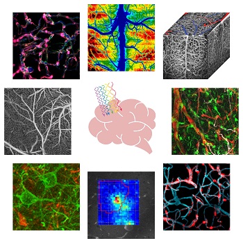 <img alt="graphic for Neurophotonics Special Section on Special Section on Imaging Neuroimmune, Neuroglial, and Neurovascular Interfaces">